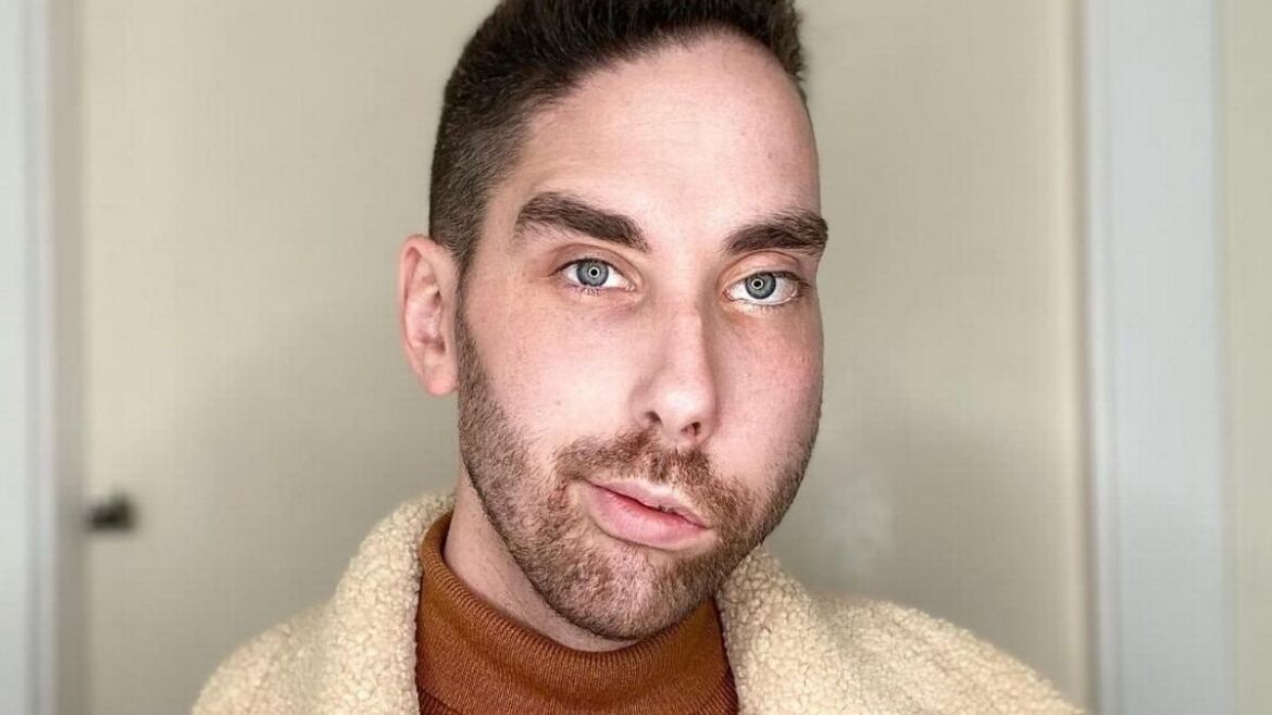 People with visible differance report rise in hostile behaviour towards them